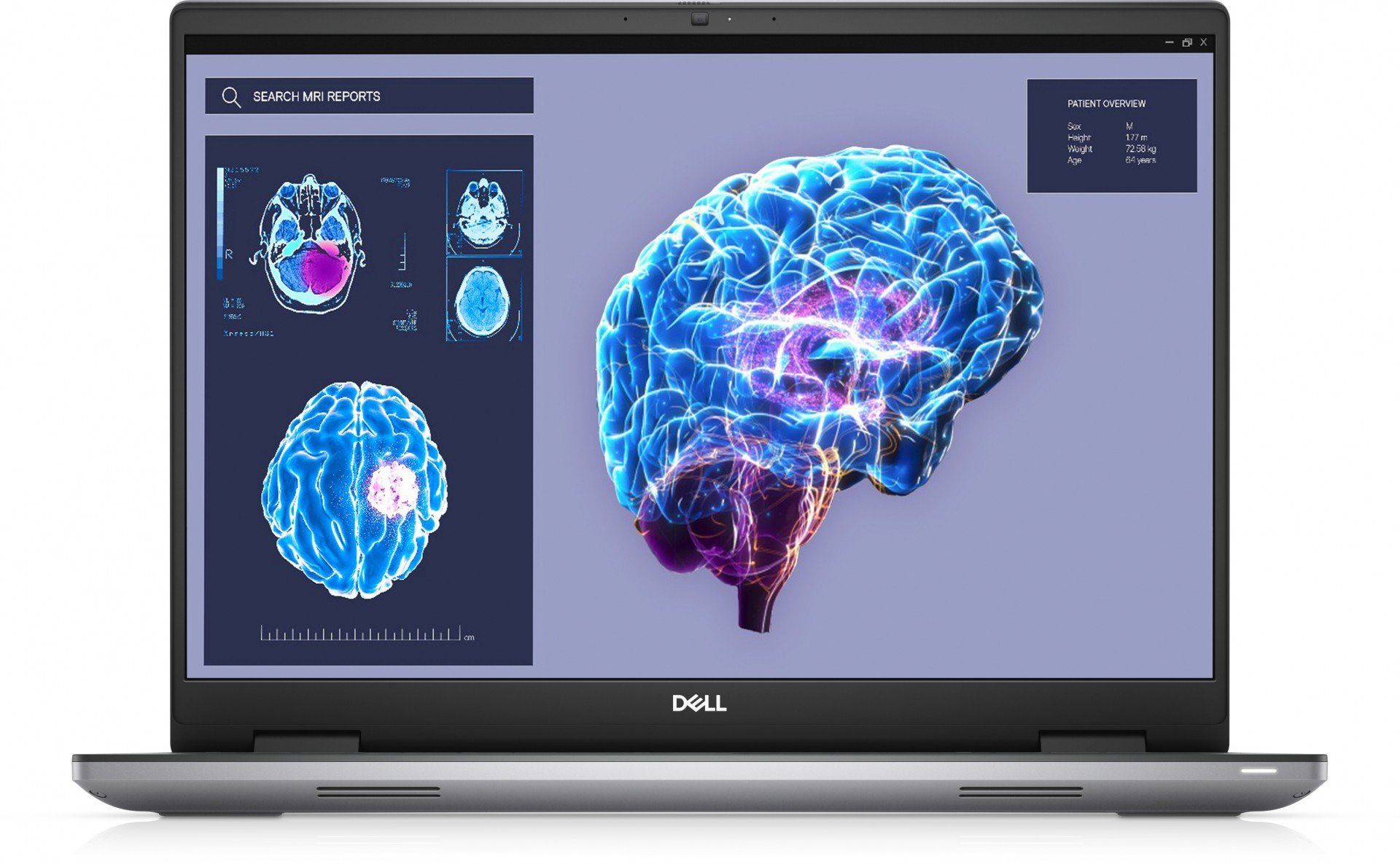 Laptop Dell Precision 7680 H21N8, 16 inch 1920 x 1200, Intel Core i7-13850HX (20 C / 28 T, 4.0 GHz - 5.30 GHz, 30 MB cache, 55 W), 32 GB DDR5, 1 TB SSD, Nvidia RTX 2000 Ada, Windows 11 Pro, Tastatura Italiana, Gri