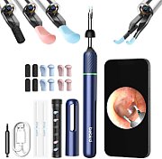Bebird Note5 Blue Otoscope with camera